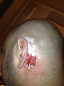 Dana White mostra curativo aps cirurgia na orelha