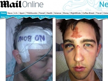 Paul Meehan perdeu parte do cr�nio e sofreu outras les�es no rosto na agress�o 