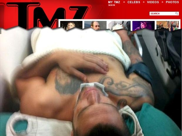 O lutador Ray Elbe fraturou o pnis durante ato sexual com a namorada