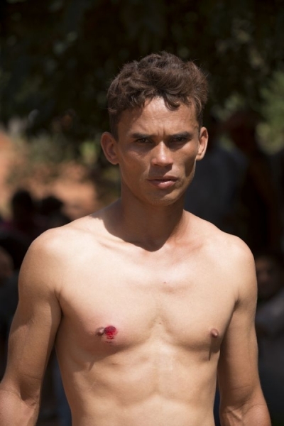 Morador mostra ferimentos aps confrondo