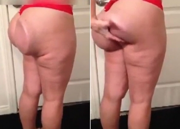 Mulher ficou com bumbum 