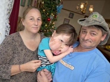 Katie teve parte de seu crebro removido quando era beb para controlar as convulses que aconteciam regularmente