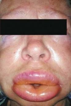 Ela fica assim, durante as crises