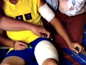 Criana teve ferimentos no brao e perna aps ataque de pit bull