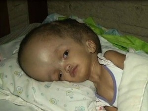 Maria Clara apresentou boa recuperao aps  cirurgia em Cuiab.