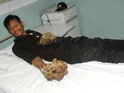 Dede Koswara  conhecido como o 