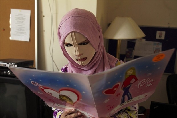 Refugiada do Iraque, Khetam usa m�scara ap�s cirurgias reconstru�rem sua face