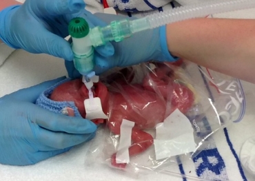 Ao nascer, Lucia Sansbury era to pequena que a equipe mdica improvisou e usou um saco de sanduche para mant-la aquecida