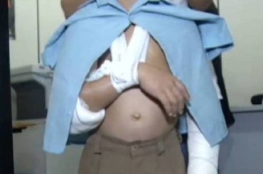 Criana tinha o brao machucado e marcas de agresso com fios