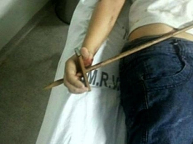 Matheus Andrade da Silva teve a mo perfurada por uma lana ao tentar pular porto em Rio Verde, Gois