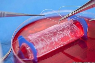 Tecido artificial foi implantando em pacientes que sofriam de m formao dos rgos genitais