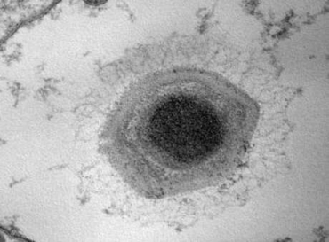 Imagem do Samba Vrus obtida no Centro de Microscopia da UFMG