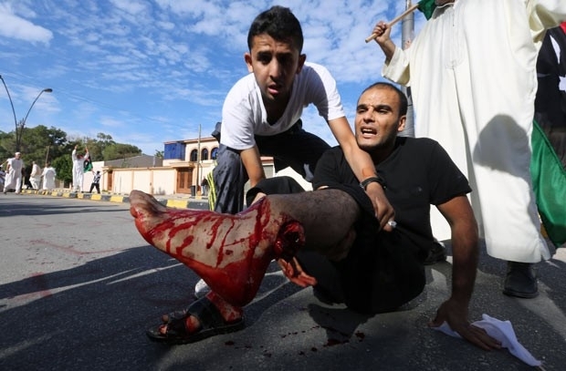 Manifestante ferido durante confrontos nesta sexta-feira (15) em Trpoli, capital da Lbia