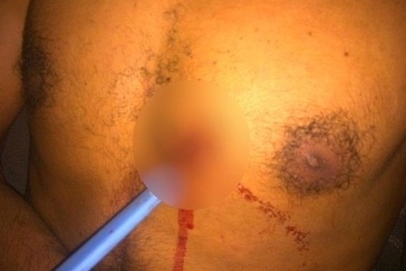 Jovem s� procurou atendimento m�dico 24 horas depois do crime