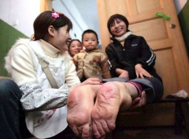 A mulher tem os ps virados para trs com a face voltada para baixo; apesar disso, consegue lidar bem com a situao