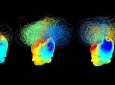 Testes mostraram que certos pacientes tm atividade crebral semelhante  de pessoas saudveis.