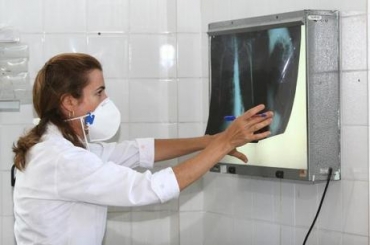 Brasil tem 6 milhes de casos de tuberculose todo ano