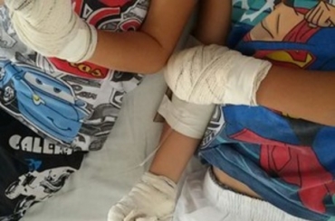 Av  suspeita de queimar os netos