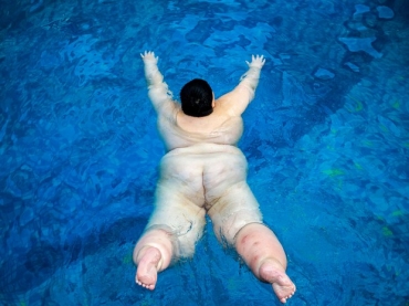 Xu Zhoulei, de 14 anos, foi diagnosticado em agosto deste ano com a sndrome de Prader-Willi