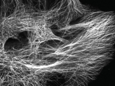 Imagem mostra tecido de crebro de camundongo