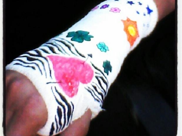 A apresentadora caiu enquanto andava de patins, no ms passado