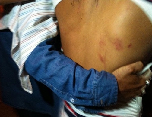 Mulher diz que foi chutada por Souza, depois de ter sido derrubada no cho