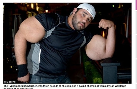 Diferena absurda entre hipertrofia de uma parte do brao para a outra denotaria uso de ADE