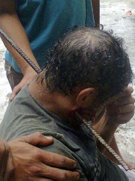 Operrio tem pescoo atravessado por vergalho em obra e chega ao hospital conversando, na Zona Sul do Rio