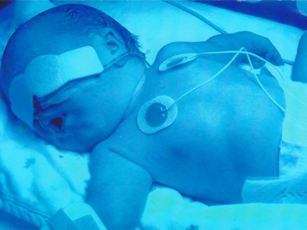 Menina surpreendeu os mdicos