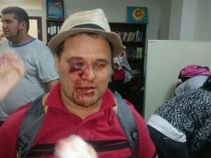 Professor de Geografia foi atingido no olho em frente  Assembleia