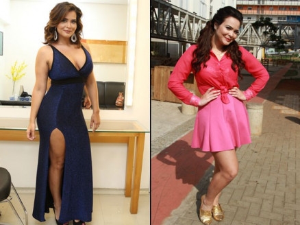 Modelo passou por 14 procedimentos estticos