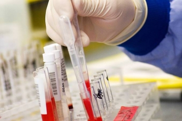 Contra o c�ncer: a recente descoberta poder� antecipar o tratamento em caso de recidiva, aumentando sua efic�cia (Getty Images/VEJA)