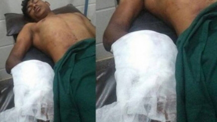 O jovem indiano aps ser operado em Hyderabad