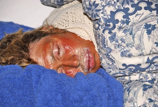 Nadadora descansa ap�s ser retirada da �gua em travessia entre Cuba e Fl�rida