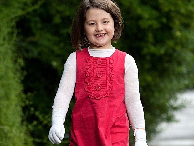 Isla aparece feliz, mesmo com o corpo todo coberto por curativos para proteg-la das alergias