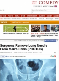 Raio-X mostra a agulha no corpo do paciente chins