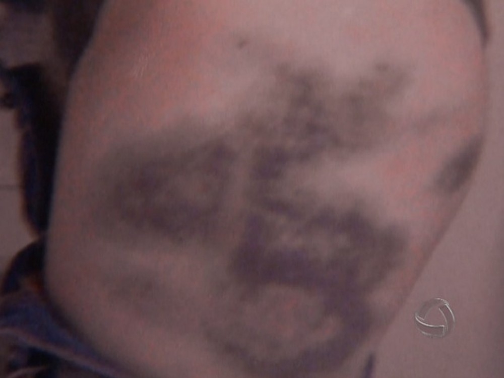 Nmero de mulheres agredidas em 2018  19% maior que em 2017.  Foto: Reproduo/TV Morena