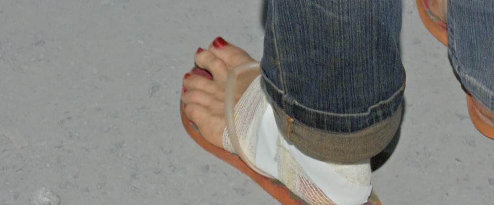 Dono do comrcio teve o p cortado durante o assalto  Foto: TVCA/Reproduo