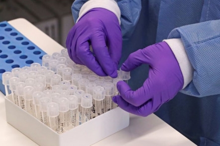 Teste para coronavrus foi realizado aps sintomas sugestivos