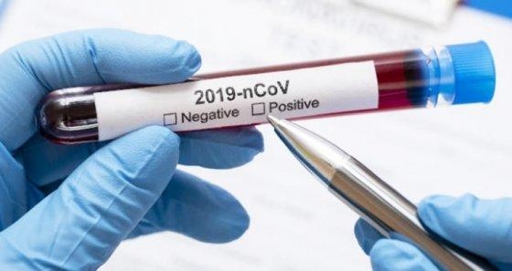 A Secretaria de Estado de Sa�de informou que, at� o momento, recebeu 16.912 testes