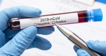 A Secretaria de Estado de Sa�de informou que, at� o momento, recebeu 16.912 testes