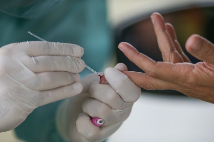 Mato Grosso registra 5.086 casos e 163 �bitos por Covid-19