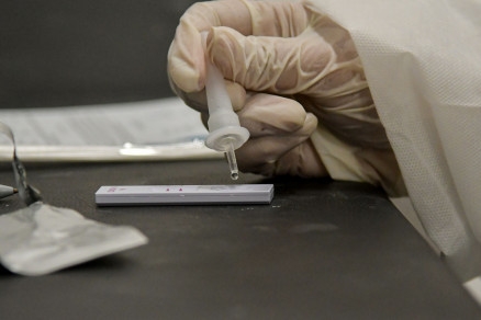 Exame para a deteco do novo coronavrus