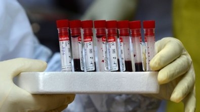 J so quase 20 mil moradores do Estado com a doena