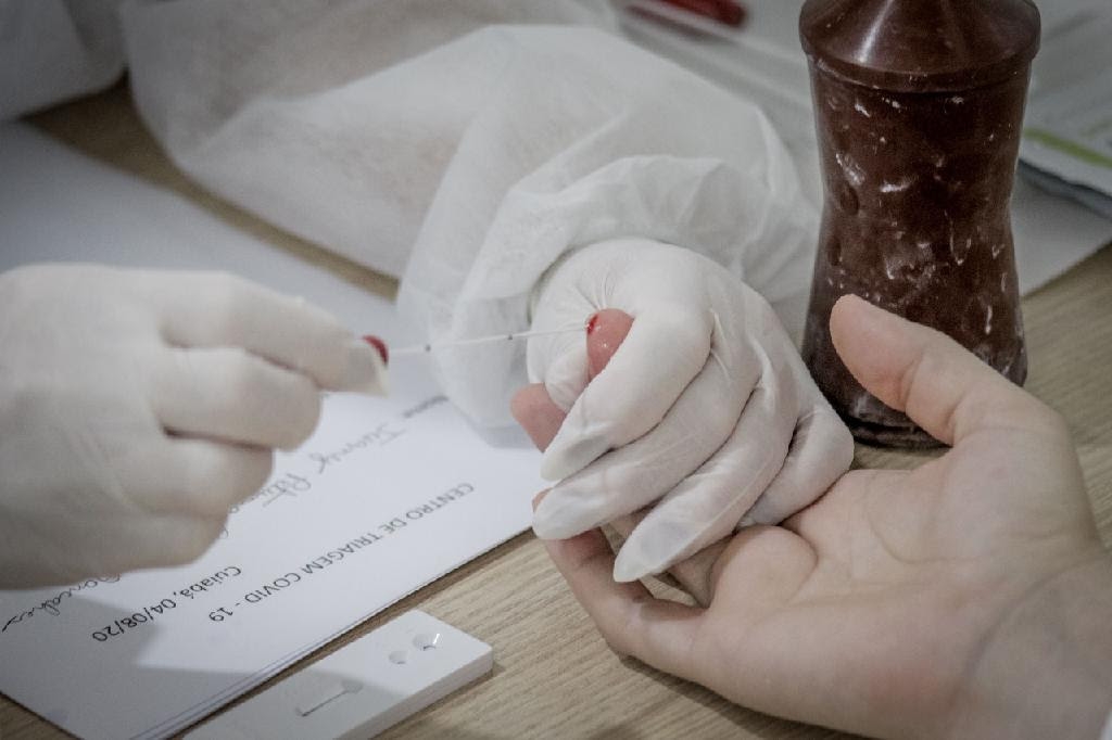 Profissionais da Sade que atuam no combate  pandemia realizam teste da Covid-19 - Foto por: Christiano Antonucci - SECOM/MT