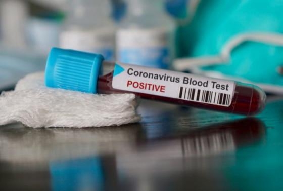 Foram notificadas 353 novas confirmaes de coronavrus no Estado, em 24horas