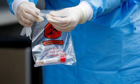 Foram notificadas 166 novas confirmaes de casos de coronavrus no Estado, em 24 horas