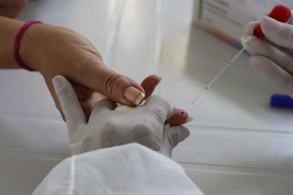 Teste para verificar se paciente possui a Covid-19  Foto: Fernanda Pimentel/FVS-AM