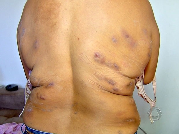 Pacientes ficaram om vrias feridas durante tratamento na clnica.