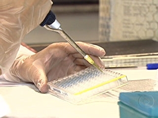 Transplante de clulas-tronco pode ter curado dois homens com HIV